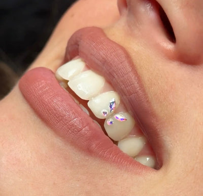 Formation Strass Dentaire